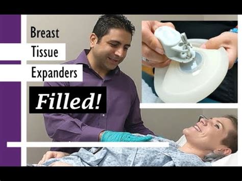 How Tissue Expanders Are Used in Breast。